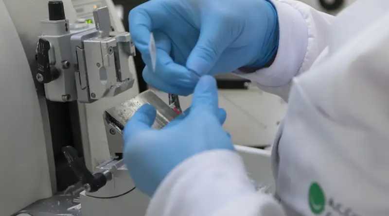 Cura de câncer de próstata pode chegar a até 98% 